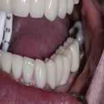 Aesthetic Dentistry Procedures in Pontefract 9